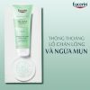 tay-te-bao-chet-eucerin-danh-cho-da-mun-100ml-2